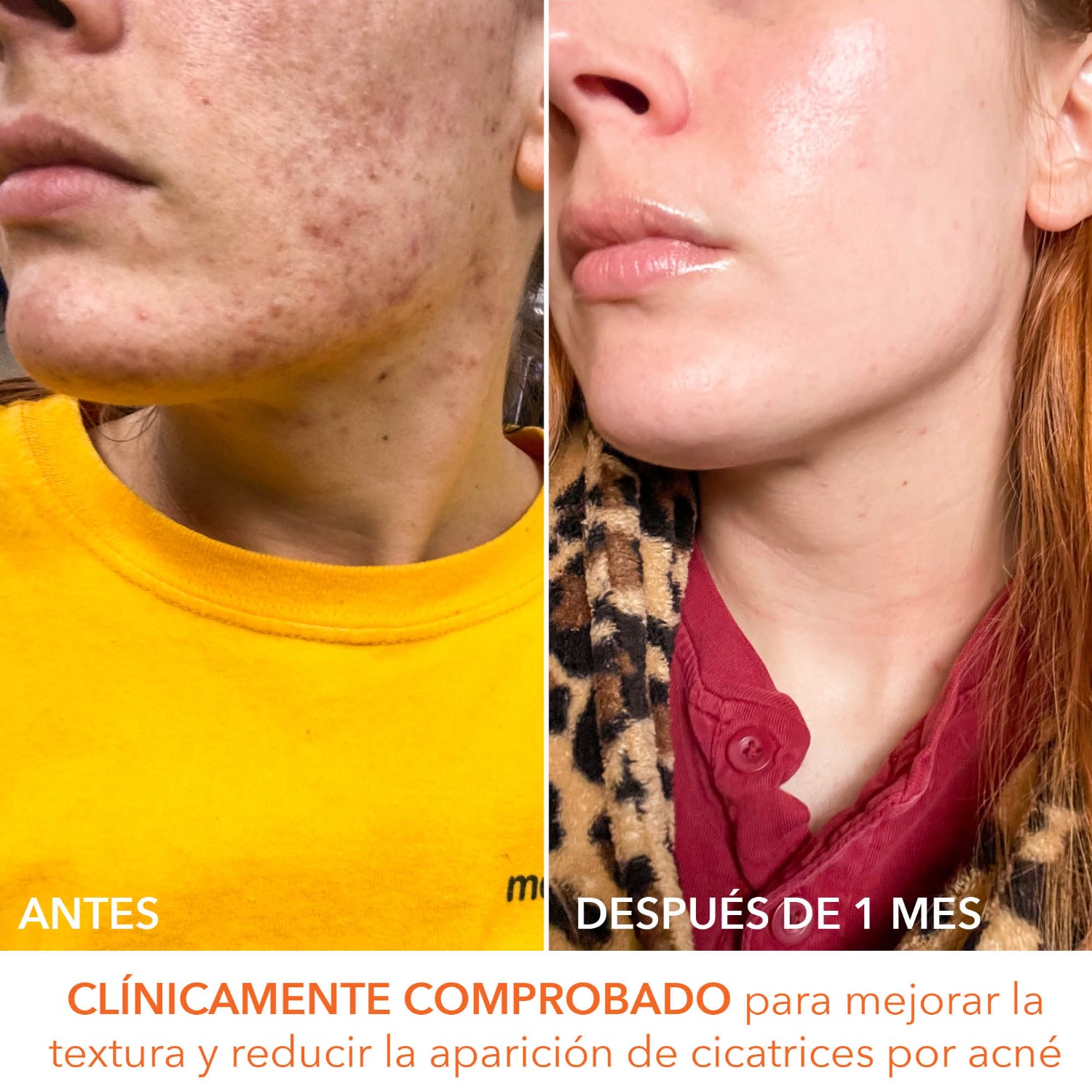 ALPHA BETA UNIVERSAL DAILY PEEL (ALMOHADILLAS EXFOLIANTES DIARIAS UNIVERSALES)
